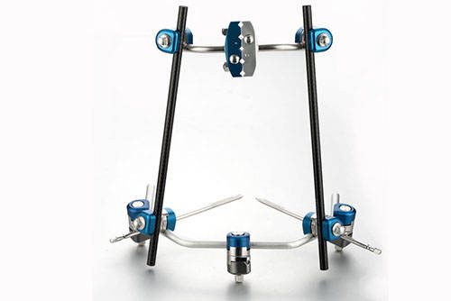 Fig 2. External fixator.